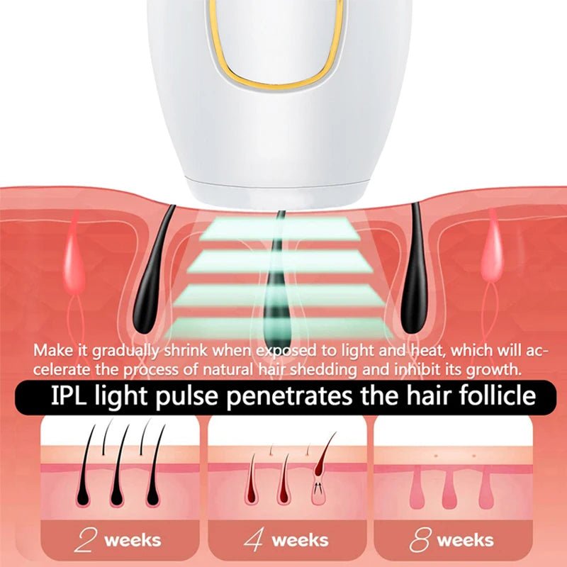 Depiladora Laser Profesional IPL - MiEspacioYmas